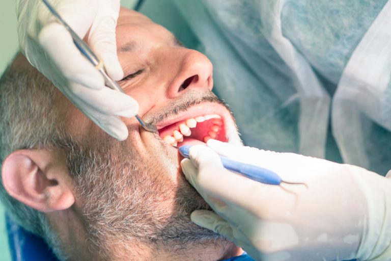 Would You Rather Implement New Software or visit the dentist?